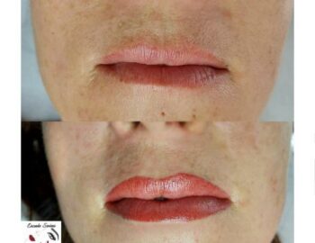 Escale Soins_Soignolles-en-Brie